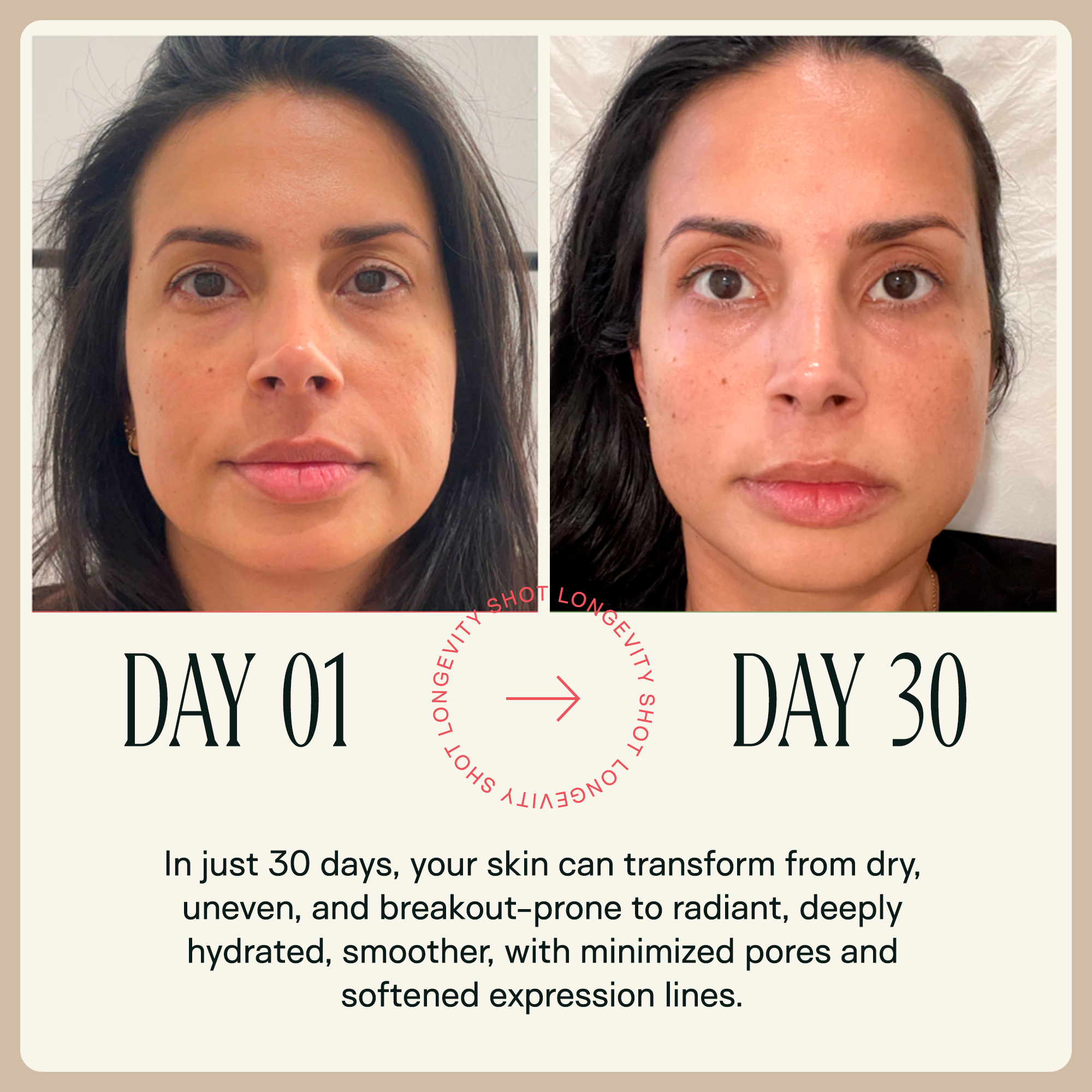 NAD+ Longevity shot™