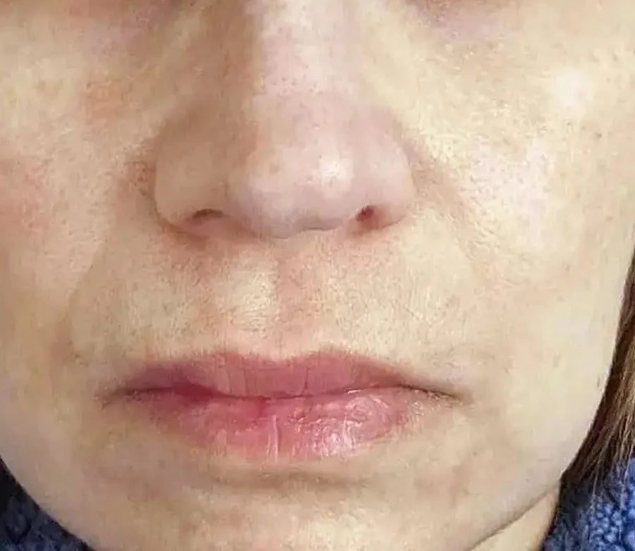 Skin before Glow Shot