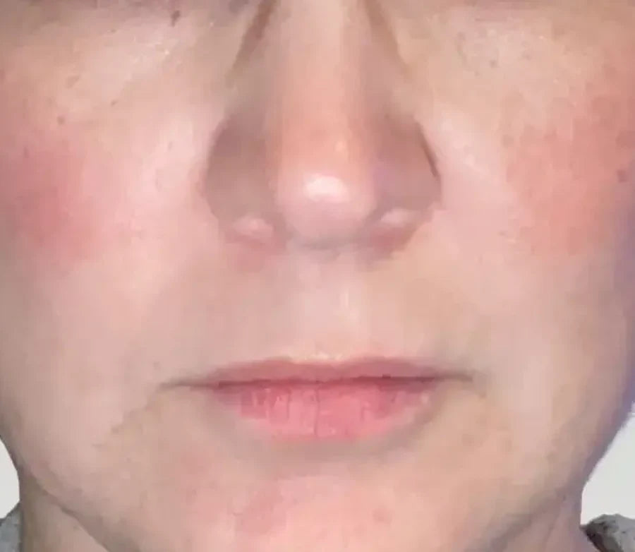 Skin before Glow Shot
