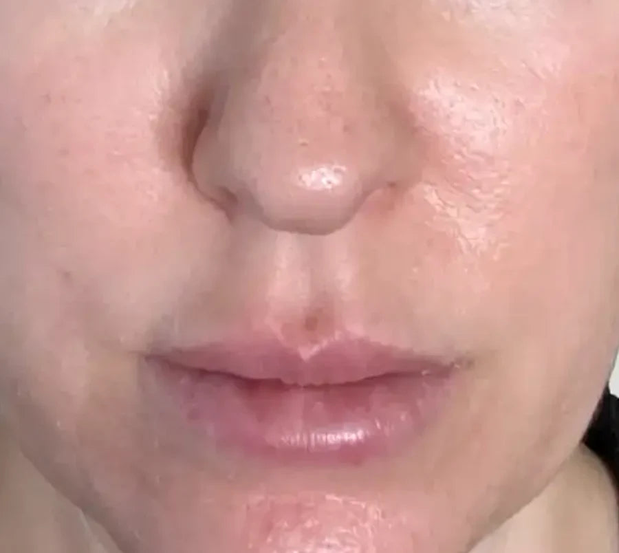 Skin before Glow Shot